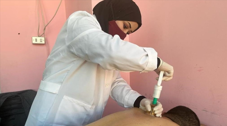 نجوان.. لاجئة سورية تخفف آلام الأردنيين بالحجامة (قصة إنسانية)